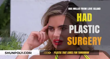Millie Love Island Plastic Surgery: Fact-Checking Transformation Rumors