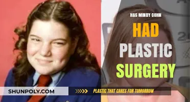 Mindy Cohn Plastic Surgery: Fact-Checking the Actress' Transformation Rumors