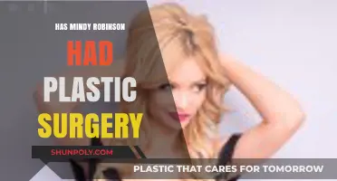 Mindy Robinson's Transformation: Plastic Surgery Speculations and Truths