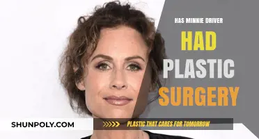 Minnie Driver's Transformation: Plastic Surgery Rumors and Reality Explored