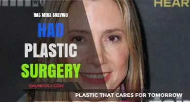 Mira Sorvino Plastic Surgery: Fact-Checking the Rumors and Speculations