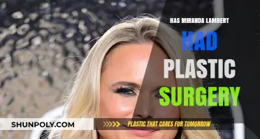 Miranda Lambert Plastic Surgery: Fact-Checking Rumors and Speculations