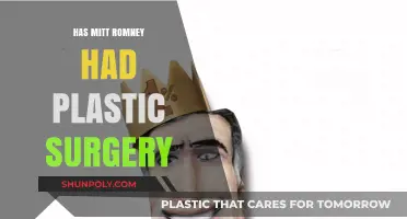 Mitt Romney's Appearance: Plastic Surgery Speculations and Rumors Explored