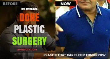 Mohanlal's Transformation: Plastic Surgery Speculations and the Truth Revealed
