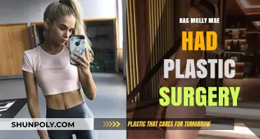 Molly-Mae's Transformation: Unveiling the Truth About Plastic Surgery Rumors