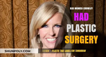 Monica Crowley's Transformation: Plastic Surgery Rumors and Speculations