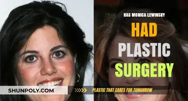 Monica Lewinsky's Transformation: Plastic Surgery Speculations and Truths Revealed