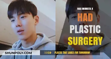 Monsta X Plastic Surgery Rumors: Fact or Fiction?