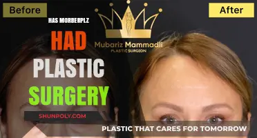 Has Morberplz Had Plastic Surgery? Uncovering the Truth Behind the Rumors
