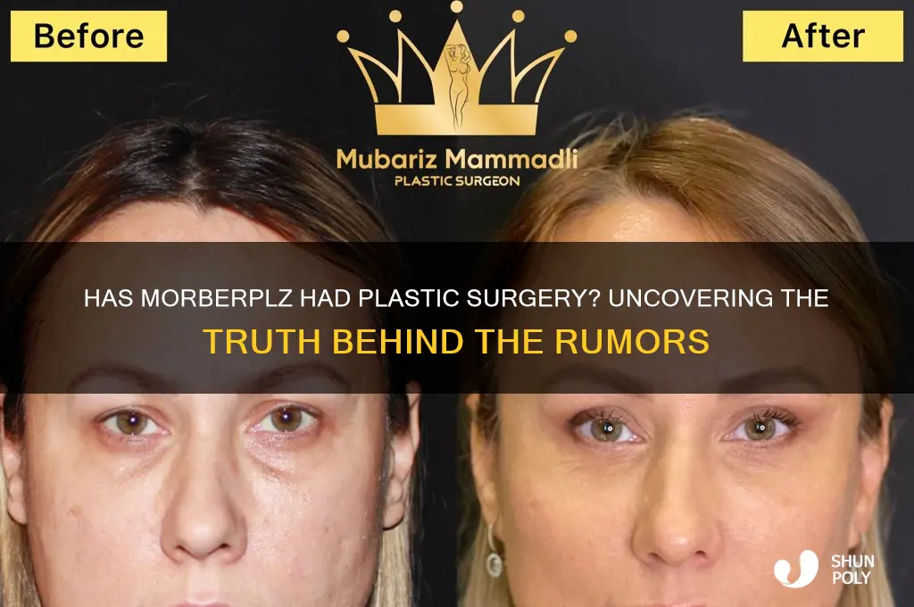 has morberplz had plastic surgery