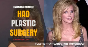 Morgan Fairchild's Transformation: Plastic Surgery Speculations and Truths Revealed