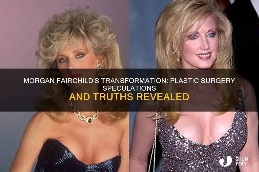 has morgan fairchild had plastic surgery