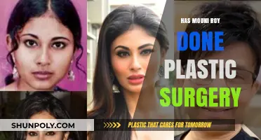 Mouni Roy's Transformation: Plastic Surgery Rumors Explored and Debunked