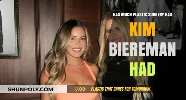 Kim Biermann's Plastic Surgery Journey: Fact-Checking Her Transformation