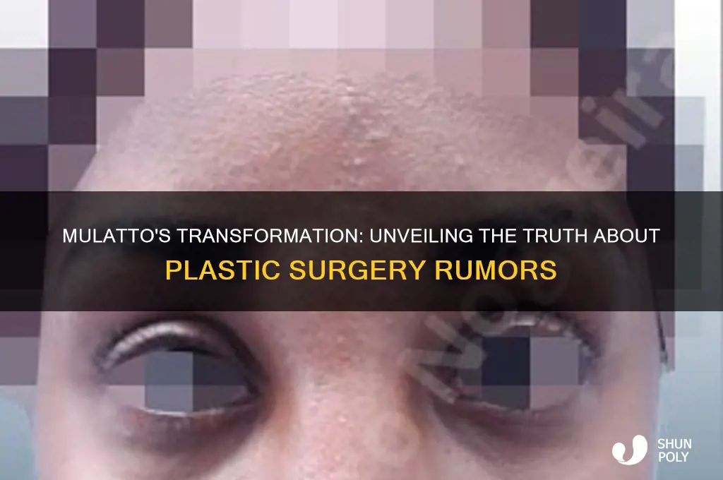 has mulatto had plastic surgery