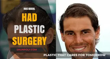 Has Rafael Nadal Undergone Plastic Surgery? Examining the Rumors