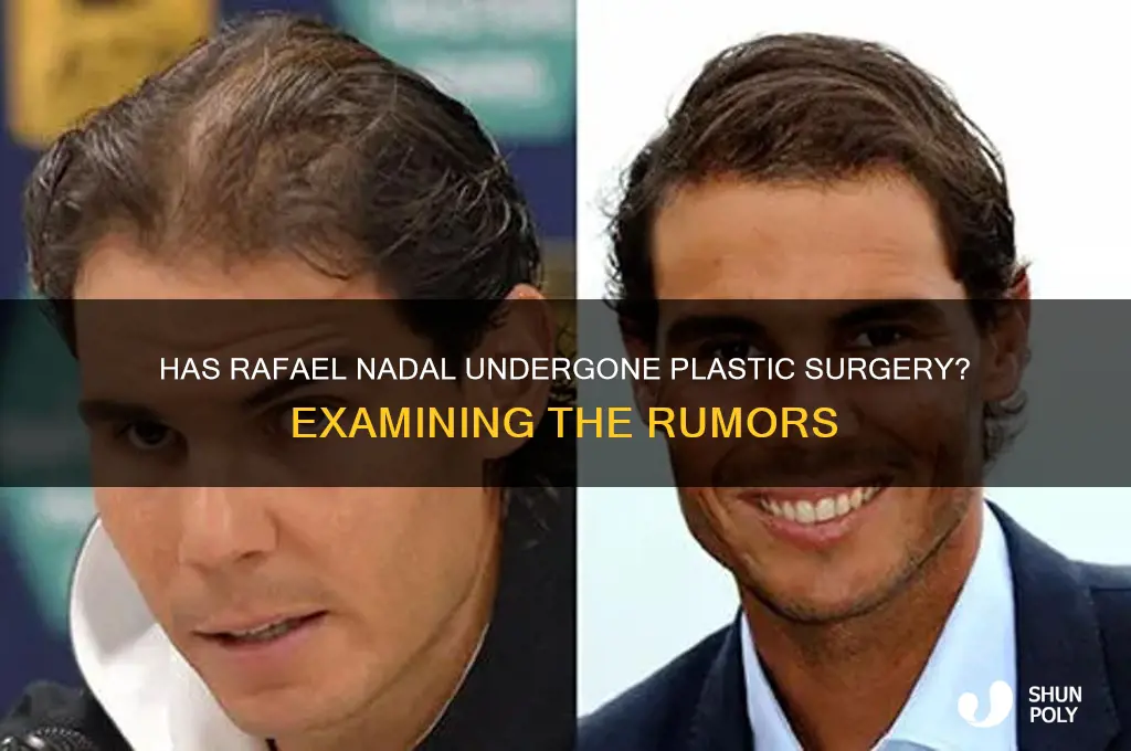 has nadal had plastic surgery