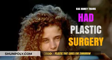Nancy Travis Plastic Surgery: Fact-Checking Rumors and Speculations