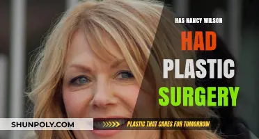 Nancy Wilson Plastic Surgery: Fact-Checking Rumors and Speculations
