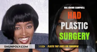 Naomi Campbell's Beauty Secrets: Plastic Surgery Rumors Explored