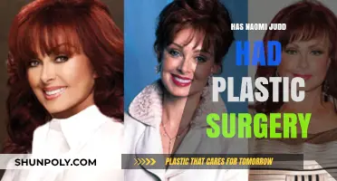 Naomi Judd's Transformation: Plastic Surgery Rumors and Reality Revealed