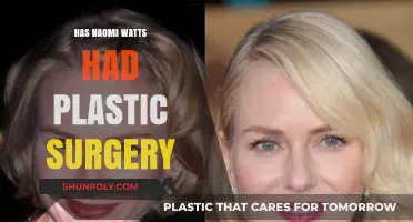 Naomi Watts Plastic Surgery: Fact-Checking the Rumors and Speculations