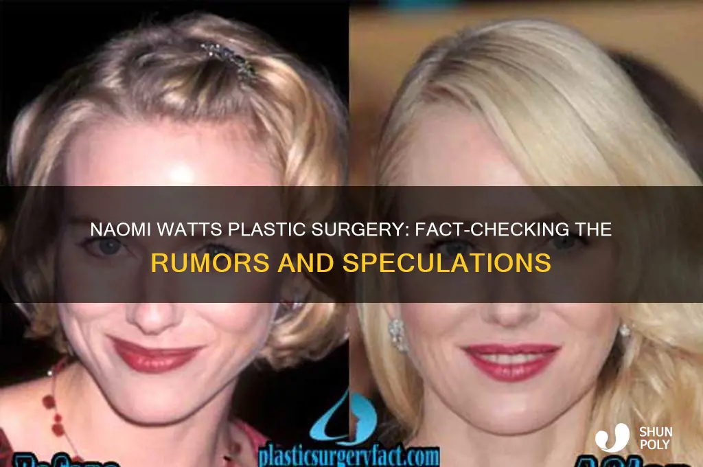 has naomi watts had plastic surgery