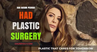 Nasim Pedrad's Transformation: Plastic Surgery Speculations and Truths