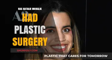 Natalie Morales Plastic Surgery: Fact-Checking the Rumors and Speculations