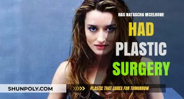 Natasha McElhone's Ageless Beauty: Plastic Surgery Speculations Explored