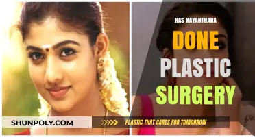 Nayanthara's Transformation: Unveiling the Truth About Plastic Surgery Rumors
