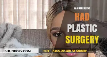 Nene Leakes Plastic Surgery: Fact-Checking Rumors and Speculations