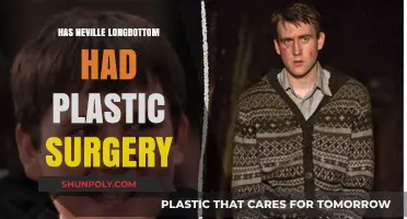 Neville Longbottom's Transformation: Plastic Surgery Rumors Explored