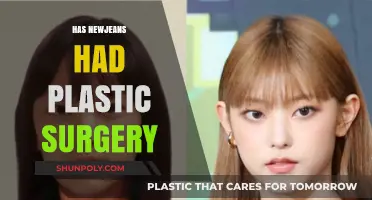 NewJeans Plastic Surgery Speculations: Fact-Checking the Rumors and Truths