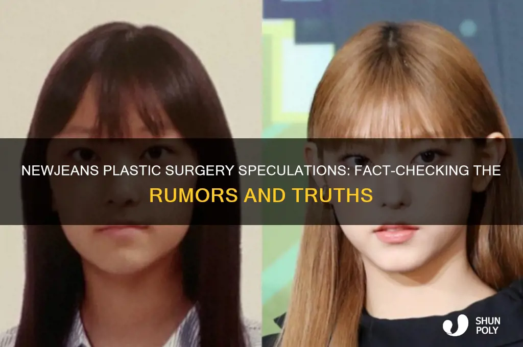 has newjeans had plastic surgery