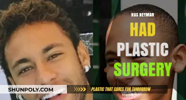Neymar's Transformation: Plastic Surgery Rumors and the Truth Behind Them