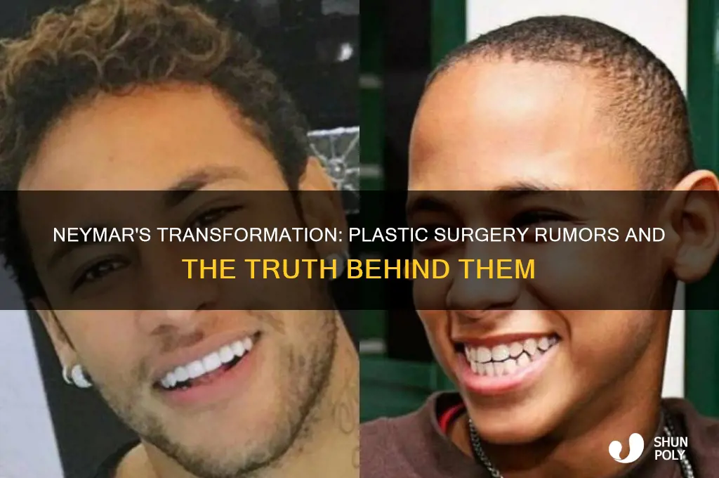 has neymar had plastic surgery