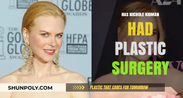 Nicole Kidman's Transformation: Plastic Surgery Rumors and Speculations
