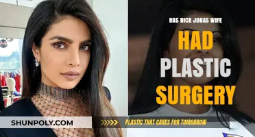 Has Nick Jonas' Wife Priyanka Chopra Had Plastic Surgery?