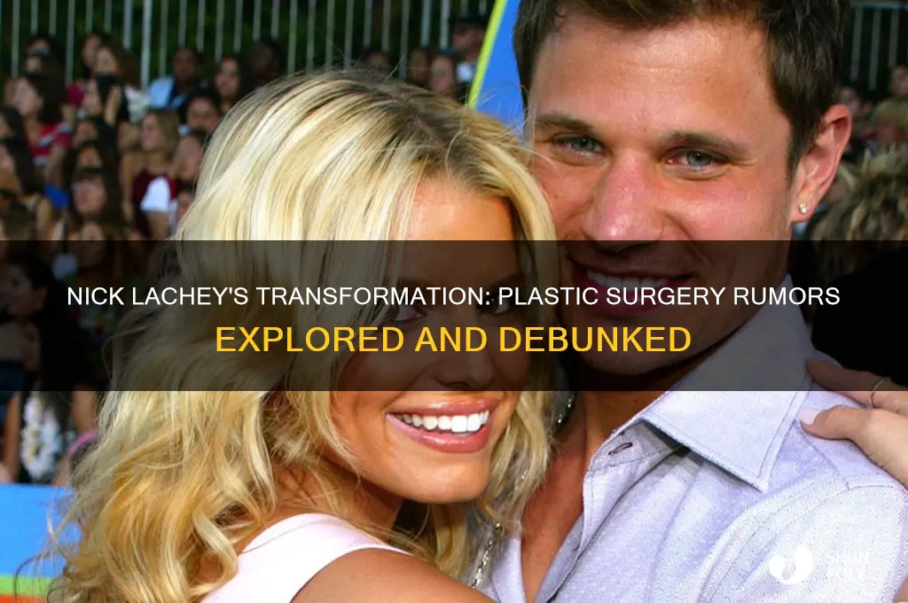 has nick lachey had plastic surgery