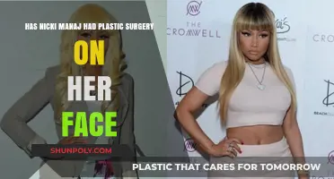 Nicki Minaj's Facial Transformation: Plastic Surgery Speculations Explored