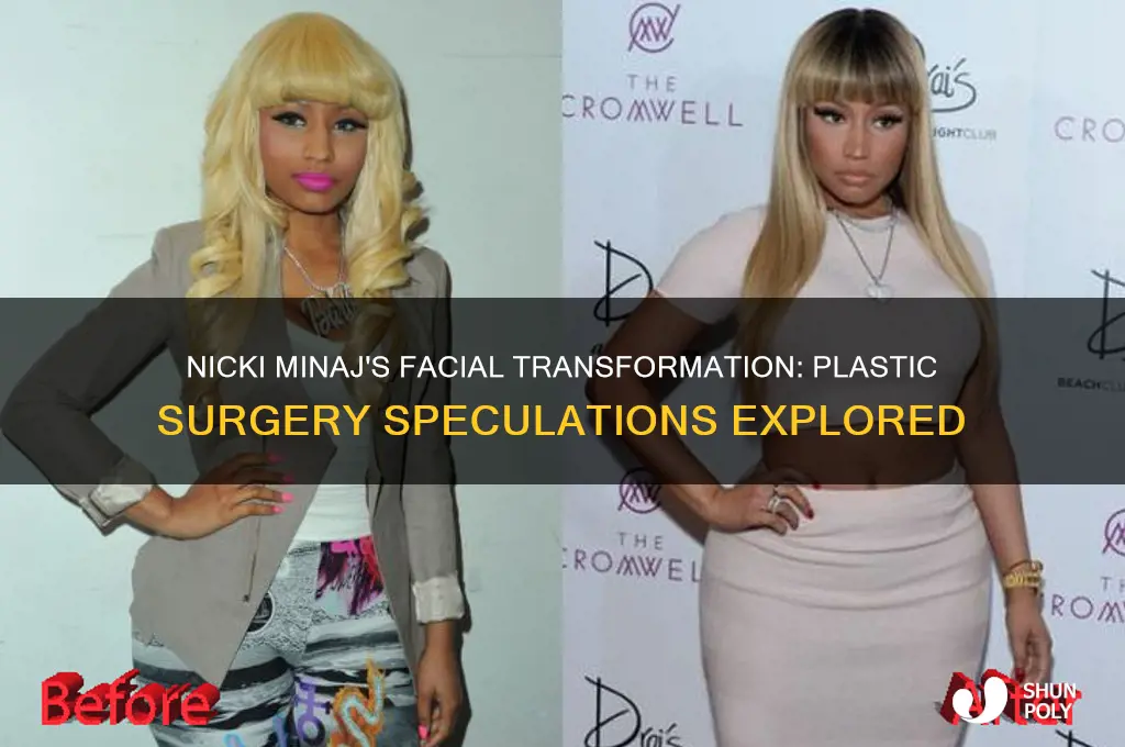 has nicki manaj had plastic surgery on her face