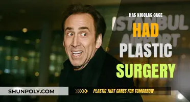 Has Nicolas Cage Had Plastic Surgery? Unveiling the Truth Behind the Rumors