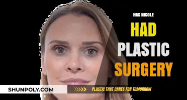 Nicole's Transformation: Unveiling the Truth About Plastic Surgery Rumors