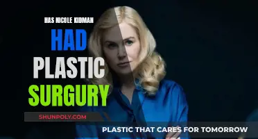 The Transformation of Nicole Kidman's Appearance