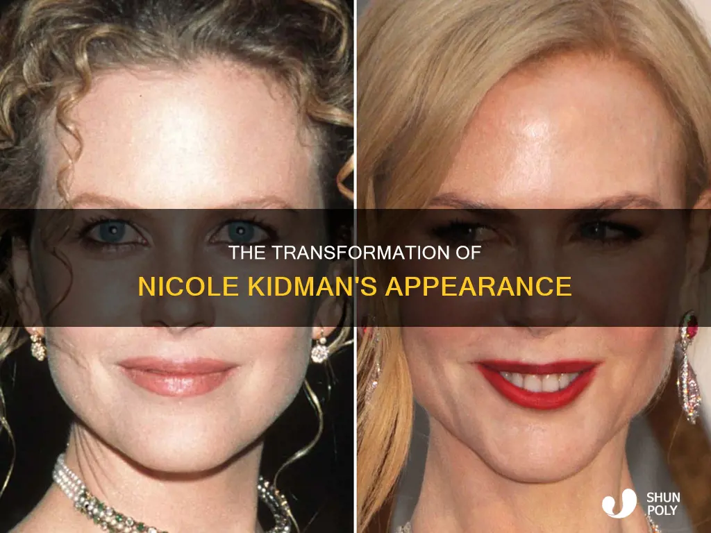 has nicole kidman had plastic surgury