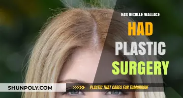 Nicolle Wallace Plastic Surgery: Fact-Checking the Rumors and Speculations