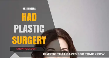 Nigella Lawson's Transformation: Plastic Surgery Rumors and Reality Revealed