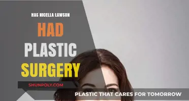 Nigella Lawson's Transformation: Plastic Surgery Rumors Explored