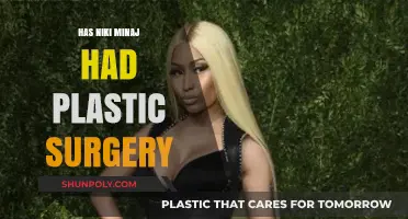Nicki Minaj's Transformation: Plastic Surgery Speculations and Truths Revealed